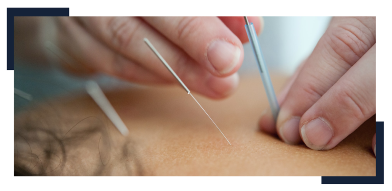 Dry Needling Physical Therapy And Its Benefits | OneRehab