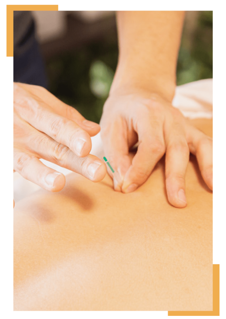 Dry Needling Physical Therapy And Its Benefits Onerehab